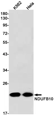NDUFB10 Rabbit Monoclonal Antibody - Size: 100µl