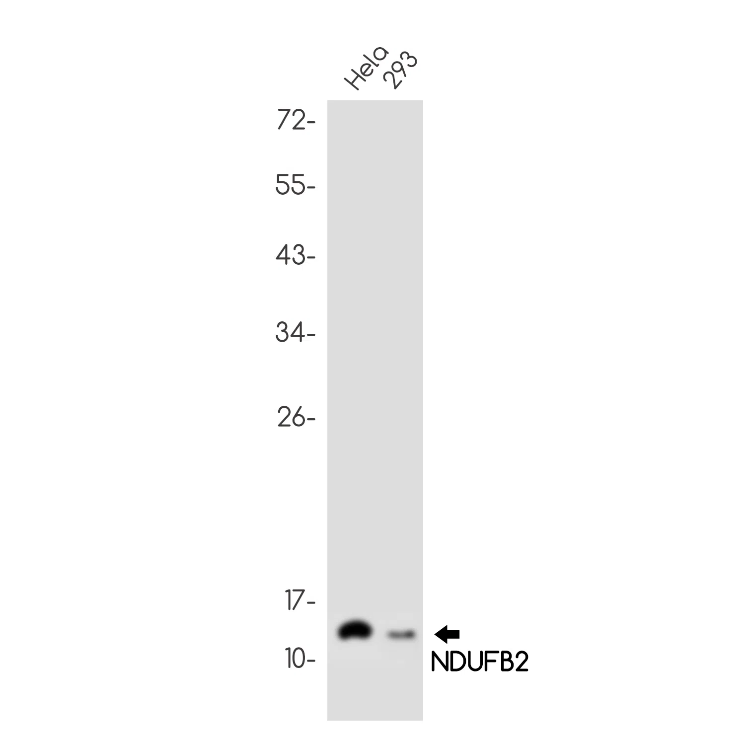 NDUFB2 Rabbit Monoclonal Antibody - Size: 100µl