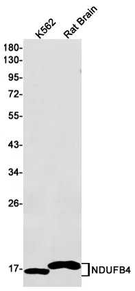 NDUFB4 Rabbit Monoclonal Antibody - Size: 50µl