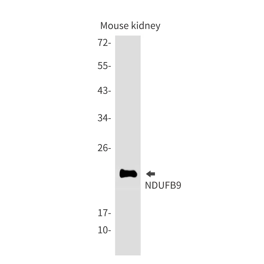 NDUFB9 Rabbit Monoclonal Antibody - Size: 50µl