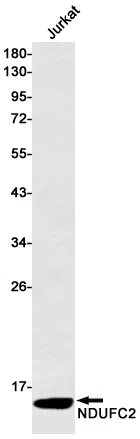 NDUFC2 Rabbit Monoclonal Antibody - Size: 50µl