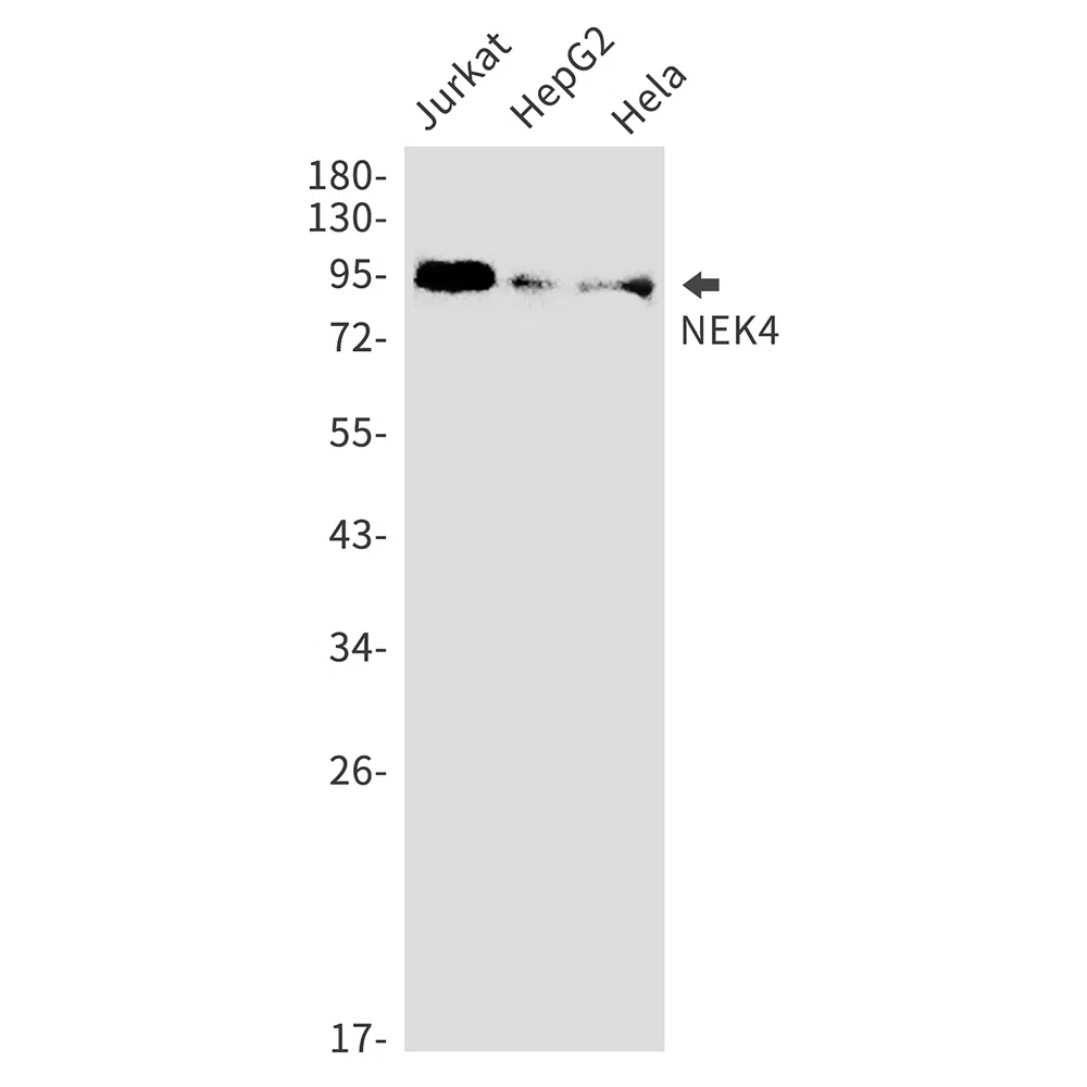 NEK4 Rabbit Monoclonal Antibody - Size: 100µl