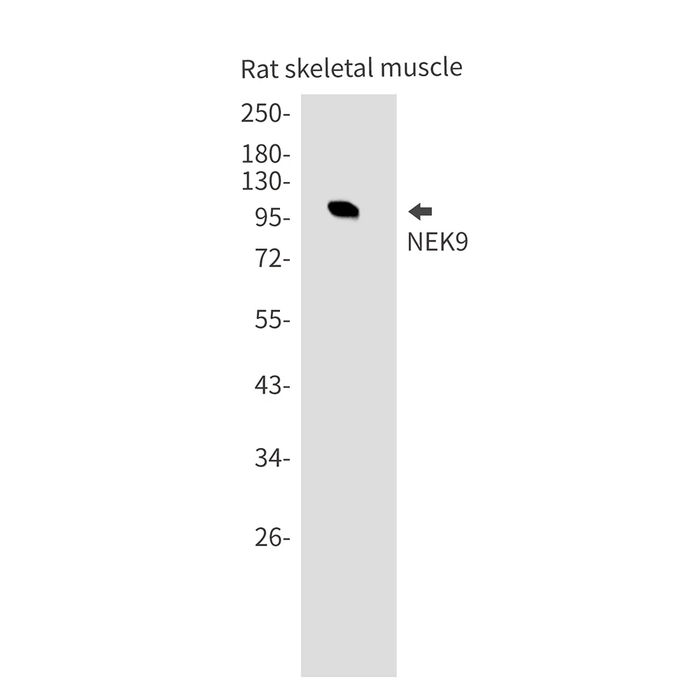 NEK9 Rabbit Monoclonal Antibody - Size: 50µl