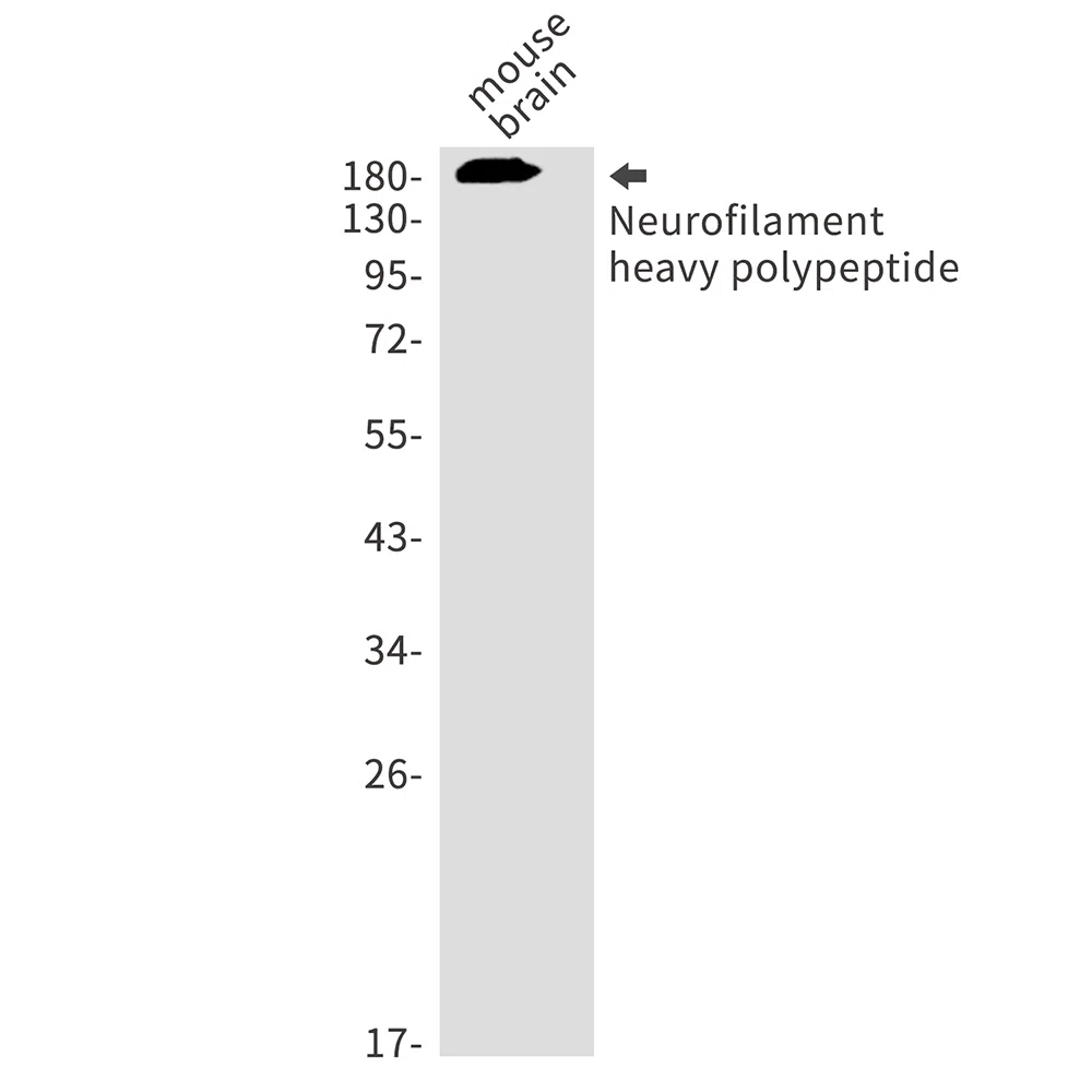 Neurofilament Heavy Polypeptide Rabbit Monoclonal Antibody - Size: 50µl