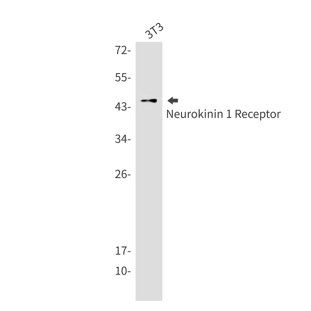 Neurokinin 1 Receptor Rabbit Monoclonal Antibody - Size: 50µl