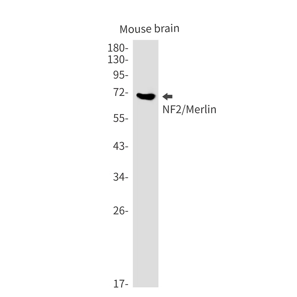 NF2 Rabbit Monoclonal Antibody - Size: 50µl