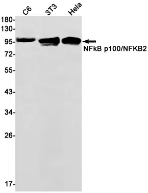 NF-KB p100 Rabbit Monoclonal Antibody - Size: 100µl