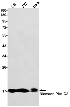 Niemann Pick C2 Rabbit Monoclonal Antibody - Size: 50µl
