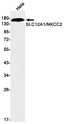 SLC12A1 Rabbit Monoclonal Antibody - Size: 50µl