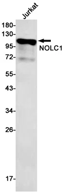 NOLC1 Rabbit Monoclonal Antibody - Size: 50µl