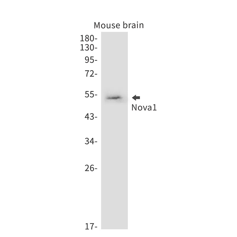 Nova1 Rabbit Monoclonal Antibody - Size: 50µl
