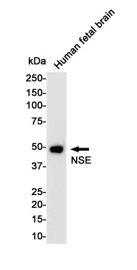 NSE Rabbit Monoclonal Antibody - Size: 50µl