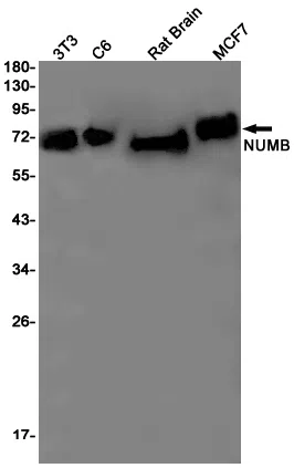 NUMB Rabbit Monoclonal Antibody