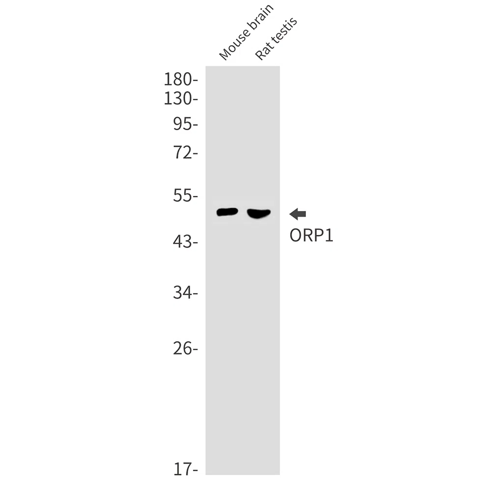 ORP1 Rabbit Monoclonal Antibody - Size: 50µl
