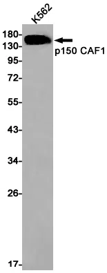 p150 CAF1 Rabbit Monoclonal Antibody - Size: 100µl