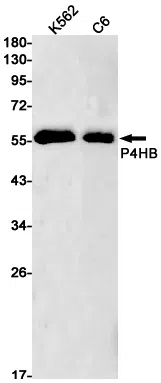 P4HB Rabbit Monoclonal Antibody