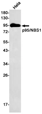 Nibrin Rabbit Monoclonal Antibody - Size: 100µl