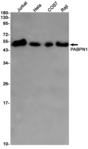 PABPN1 Rabbit Monoclonal Antibody - Size: 50µl