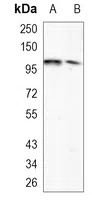 ARHGAP26 Rabbit Monoclonal Antibody - Size: 100µl
