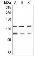 PHF8 Rabbit Monoclonal Antibody - Size: 50µl