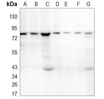 ALDH16A1 Rabbit Monoclonal Antibody - Size: 100µl