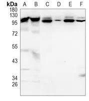 TNPO3 Rabbit Monoclonal Antibody - Size: 50µl