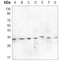 RYBP Rabbit Monoclonal Antibody - Size: 50µl