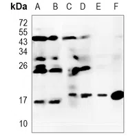 PFDN5 Rabbit Monoclonal Antibody - Size: 100µl