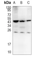 CSN1S1 Rabbit Monoclonal Antibody - Size: 50µl