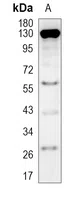 SRD5A2 Rabbit Monoclonal Antibody - Size: 50µl