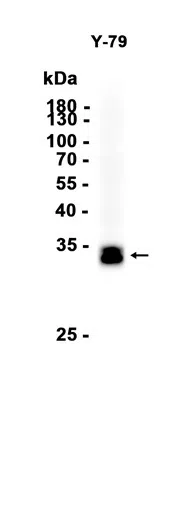Otx2 Rabbit Monoclonal Antibody - Size: 100µl