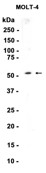 Chk1 Rabbit Monoclonal Antibody - Size: 50µl