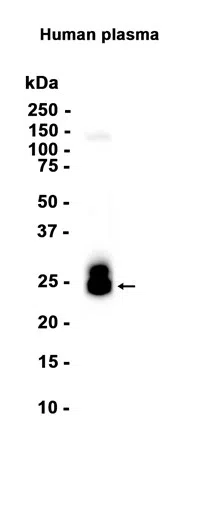 Lambda Light chain Rabbit Monoclonal Antibody - Size: 100µl
