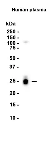 Kappa Light chain Rabbit Monoclonal Antibody - Size: 50µl