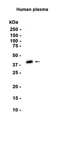 Haptoglobin Rabbit Monoclonal Antibody - Size: 50µl