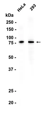 IRAK1 Rabbit Monoclonal Antibody - Size: 50µl