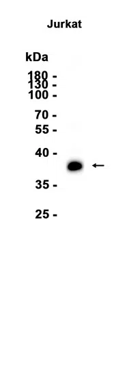 Ogg1 Rabbit Monoclonal Antibody - Size: 50µl
