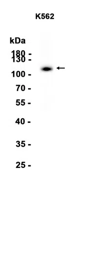 UBA1 Rabbit Monoclonal Antibody - Size: 50µl