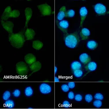 Niemann Pick C1 Rabbit Monoclonal Antibody - Size: 100µl