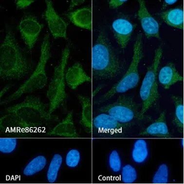 Osteoprotegerin Rabbit Monoclonal Antibody - Size: 100µl