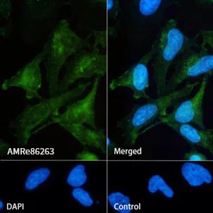 CD147 Rabbit Monoclonal Antibody - Size: 100µl