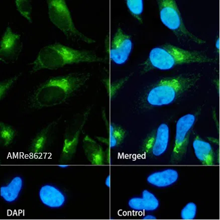 PKA R2 Rabbit Monoclonal Antibody - Size: 100µl