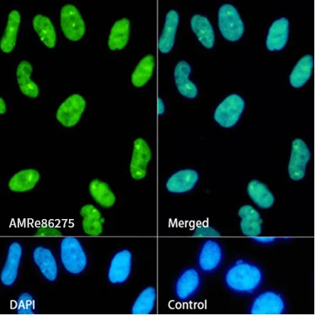 SAM68 Rabbit Monoclonal Antibody - Size: 50µl