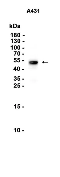 Cytokeratin 13 Rabbit Monoclonal Antibody - Size: 50µl