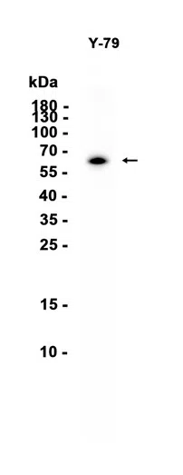 SOX11 Rabbit Monoclonal Antibody - Size: 50µl