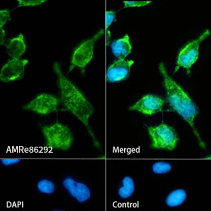 SLC1A5 Rabbit Monoclonal Antibody - Size: 100µl