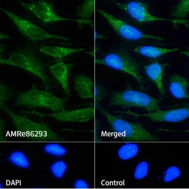 MTAP Rabbit Monoclonal Antibody - Size: 50µl
