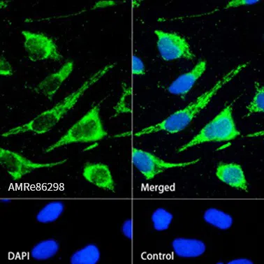 Ubiquitin Rabbit Monoclonal Antibody - Size: 50µl
