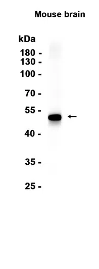 GFAP Rabbit Monoclonal Antibody - Size: 100µl