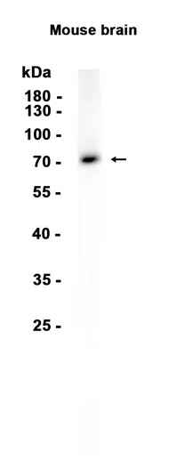 Choline Acetyltransferase Rabbit Monoclonal Antibody - Size: 100µl